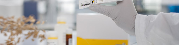 Aflotoksin ve Mikotoksin Testleri