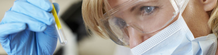 Dietilen Glikol Testi